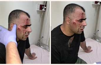 Gazeteci Aygül'e yapılan saldırıya tepkiler devam ediyor