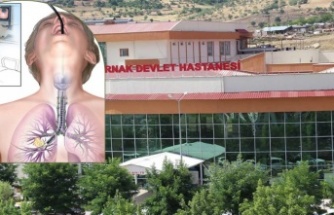 Şırnak’ta Bronskopi cihazı Bozok