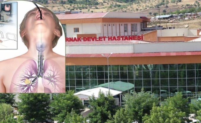 Şırnak’ta Bronskopi cihazı Bozok